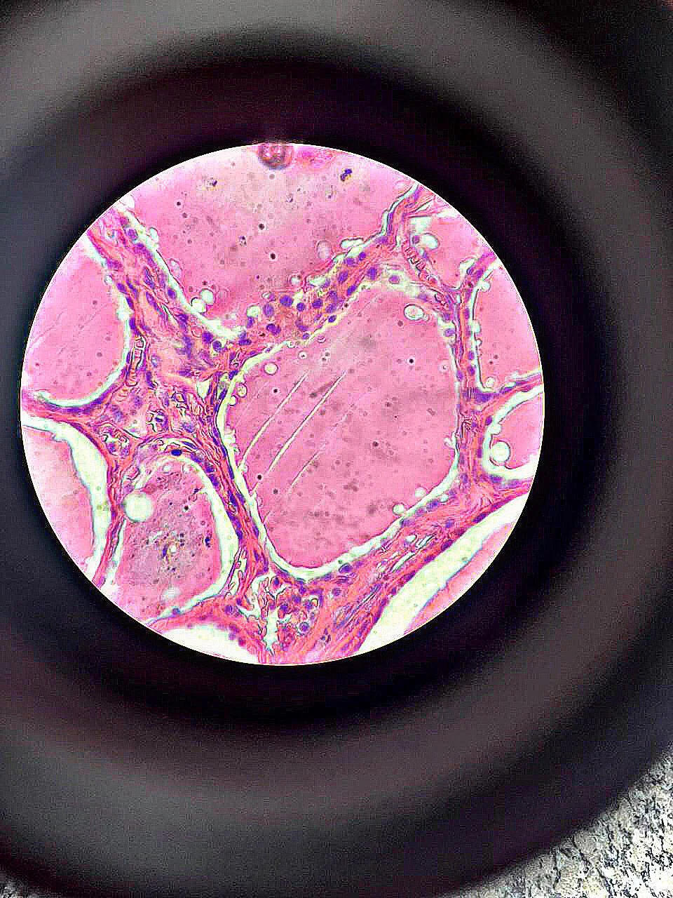 Microscopic view of pink-stained tissue with purple fibers and cells, resembling a biological structure. The image is circular with a dark surrounding, possibly a lens.